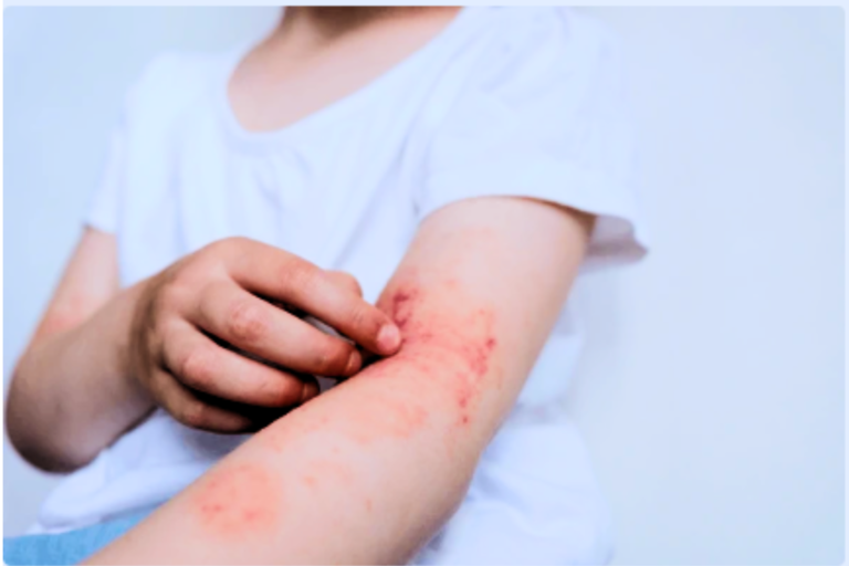 How To Protect Children Skin From Scratching